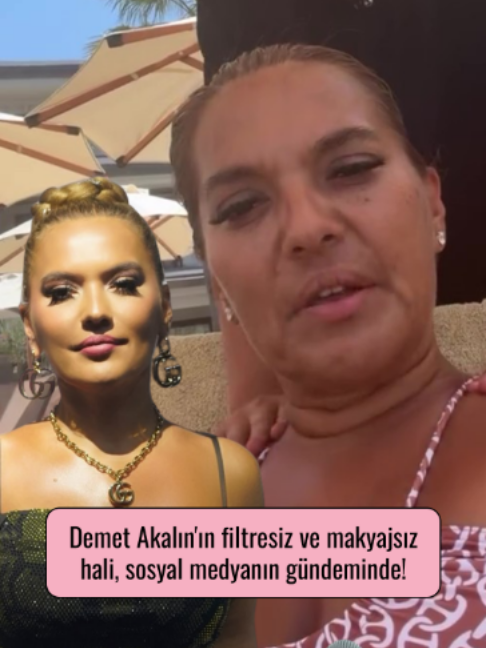 @Mynet Kadin