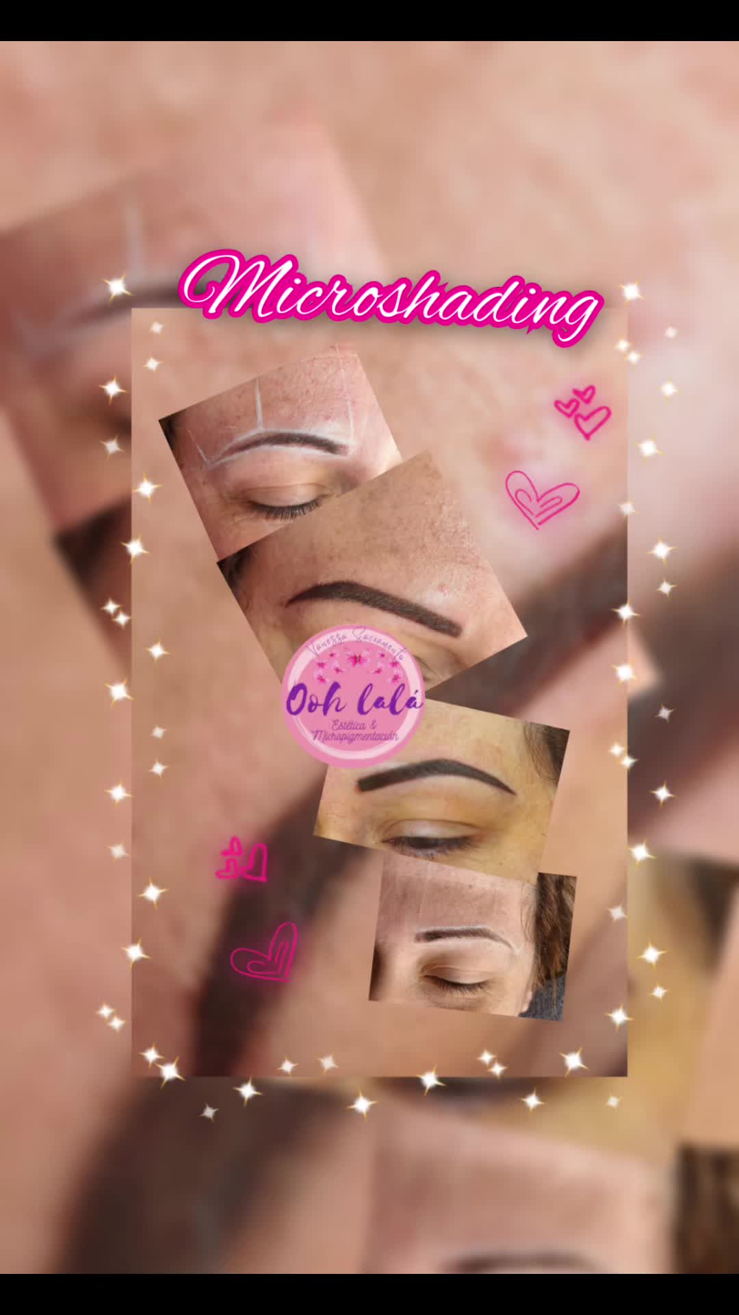@Oohlal&aacute; Est&eacute;tic