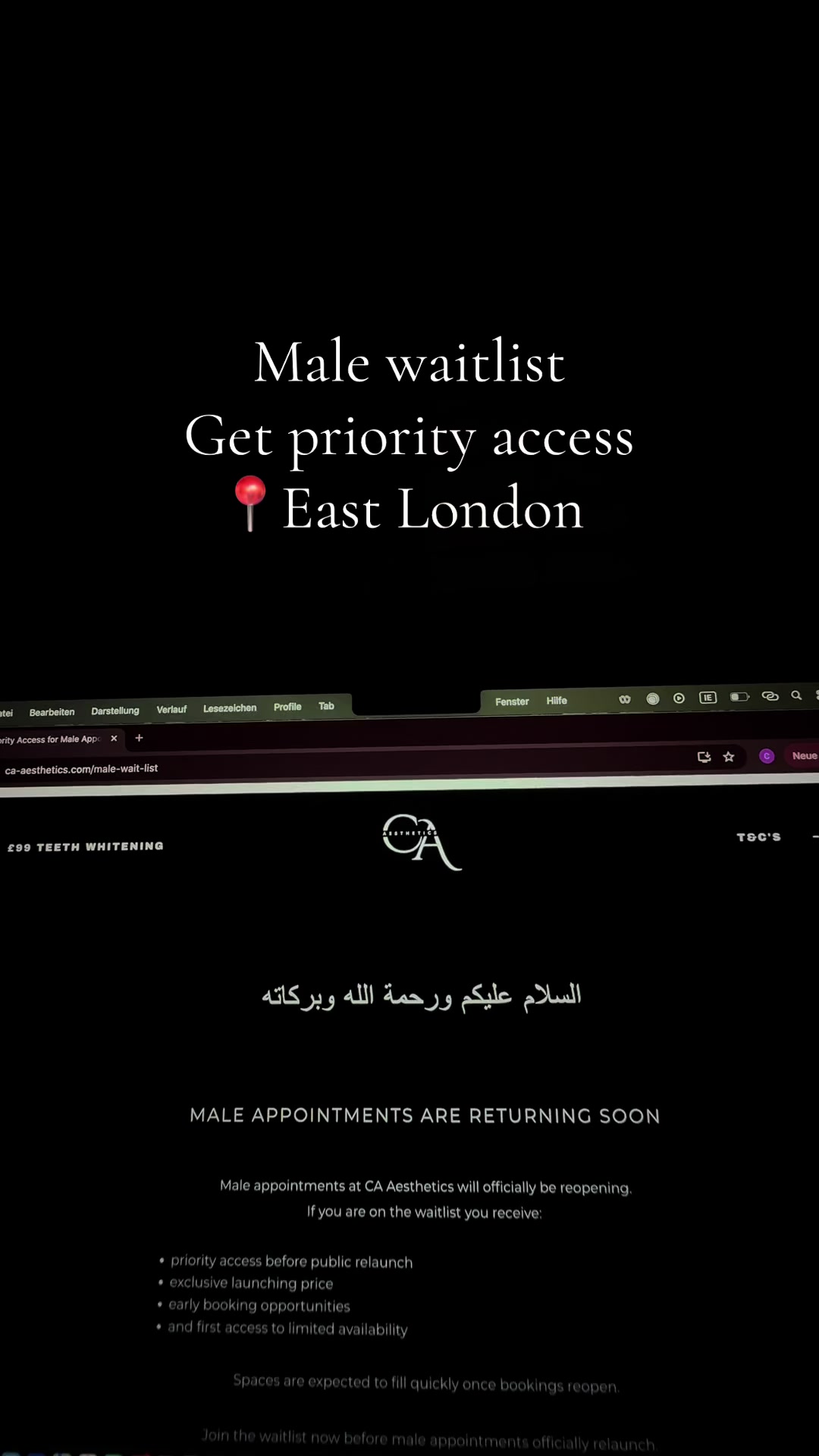 @Halal Teeth Whitening London