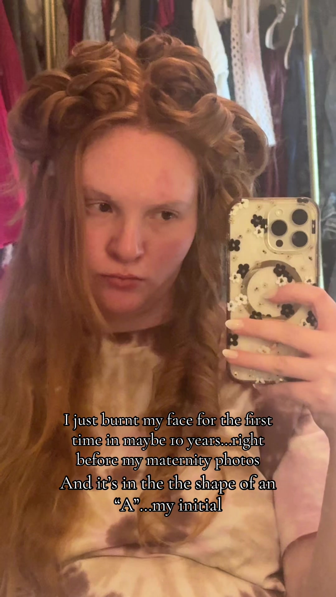 @Abigail