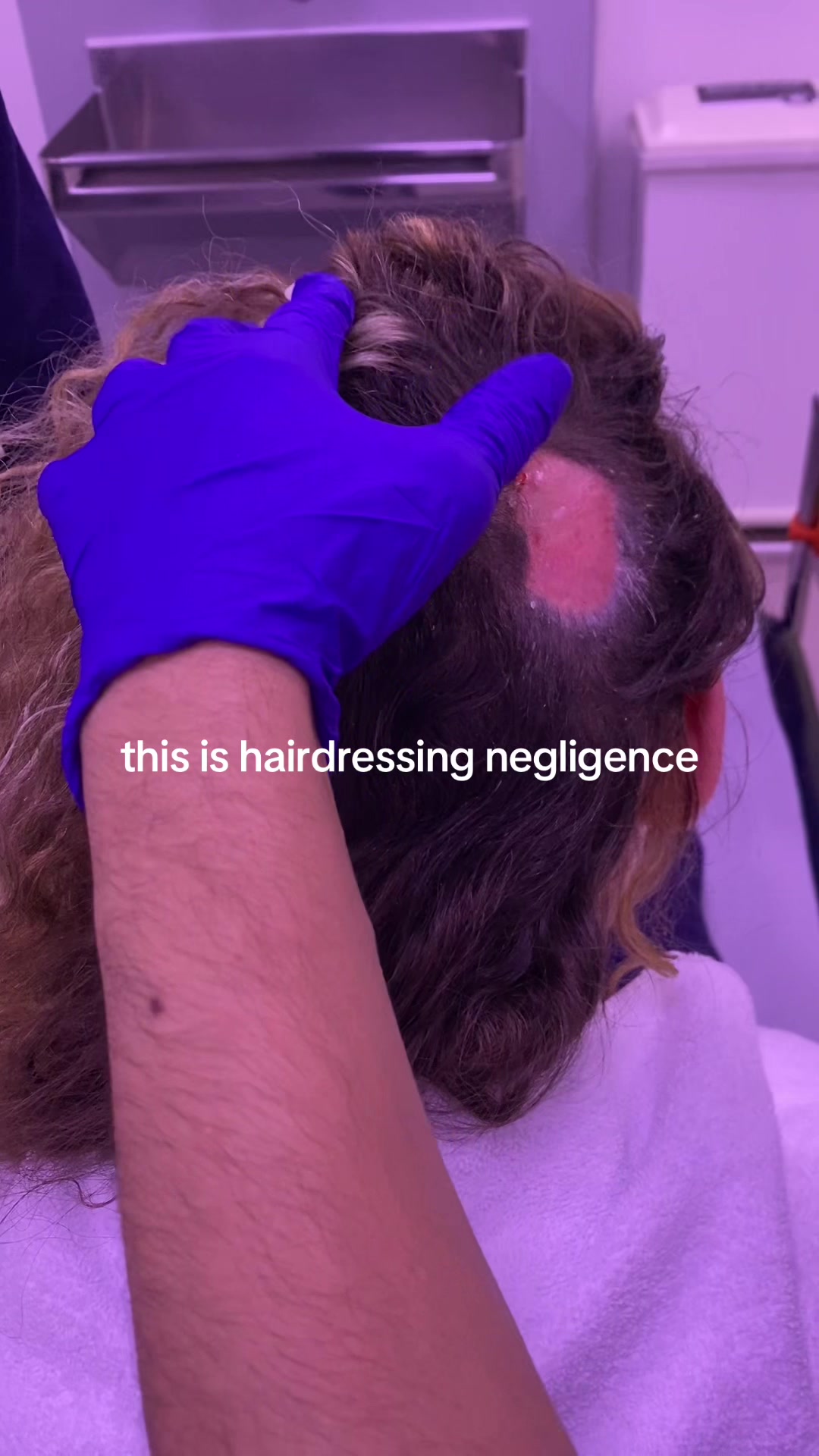 @coco❤️&zwj;🩹and💇&zwj;♀️burt.the.burn