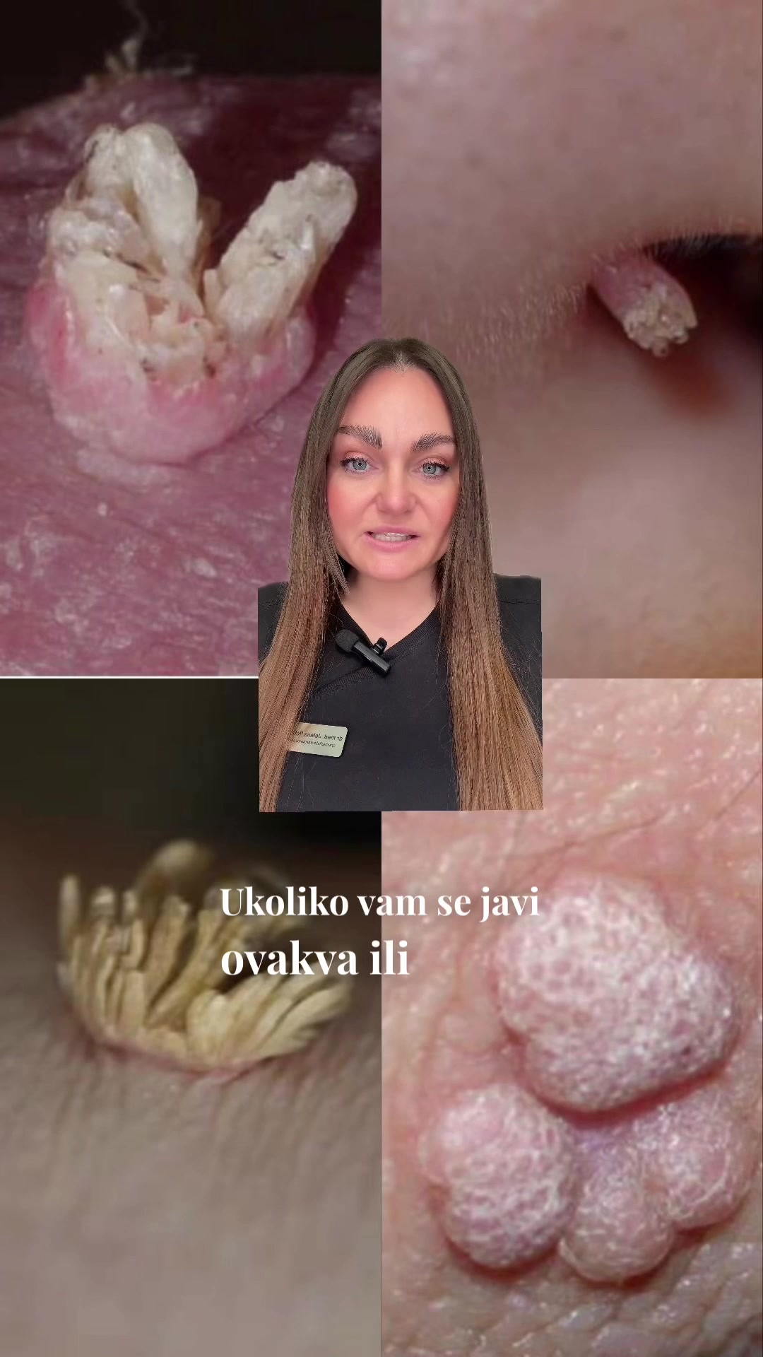 @DivaLaserCentar