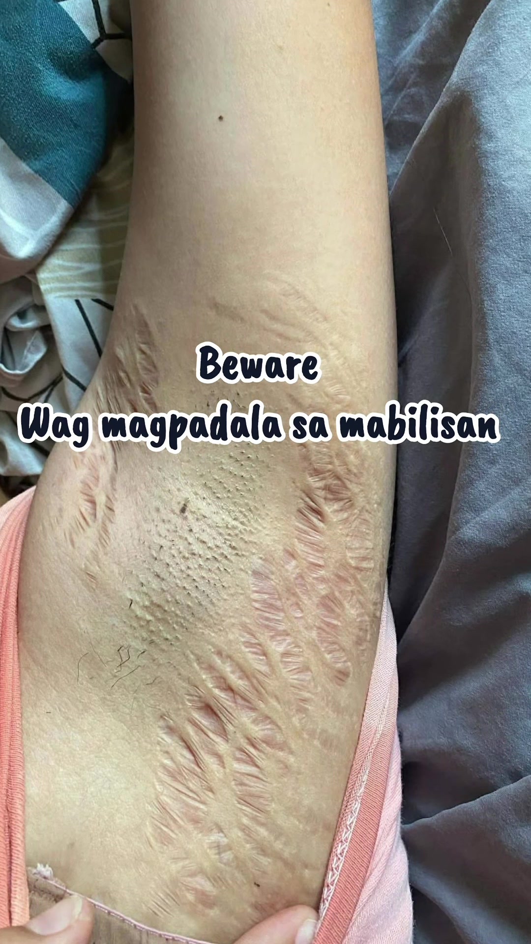@Patricia Mae Parian