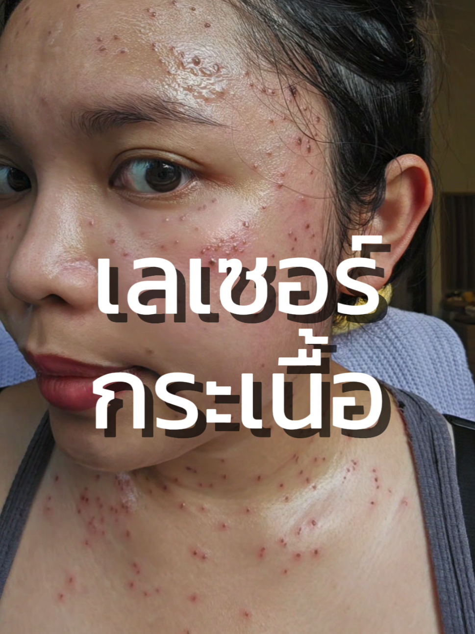 @น้องจูนจิ มีหัวใจ 7 ห้อง💚