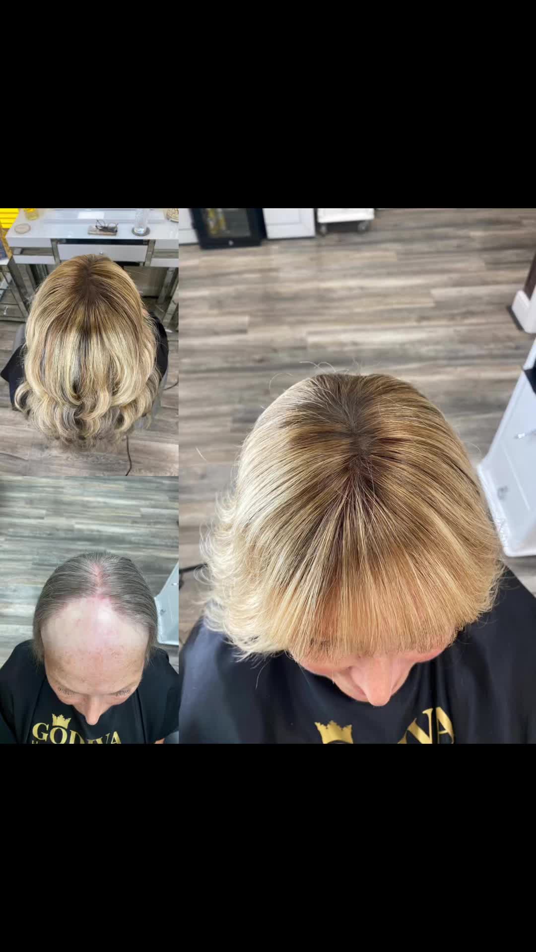 @Godiva Hair Loss Specialists