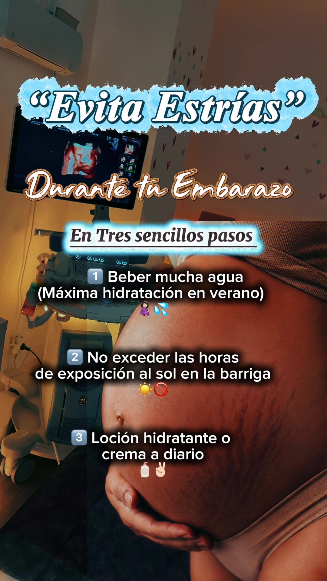 @Abel Pérez