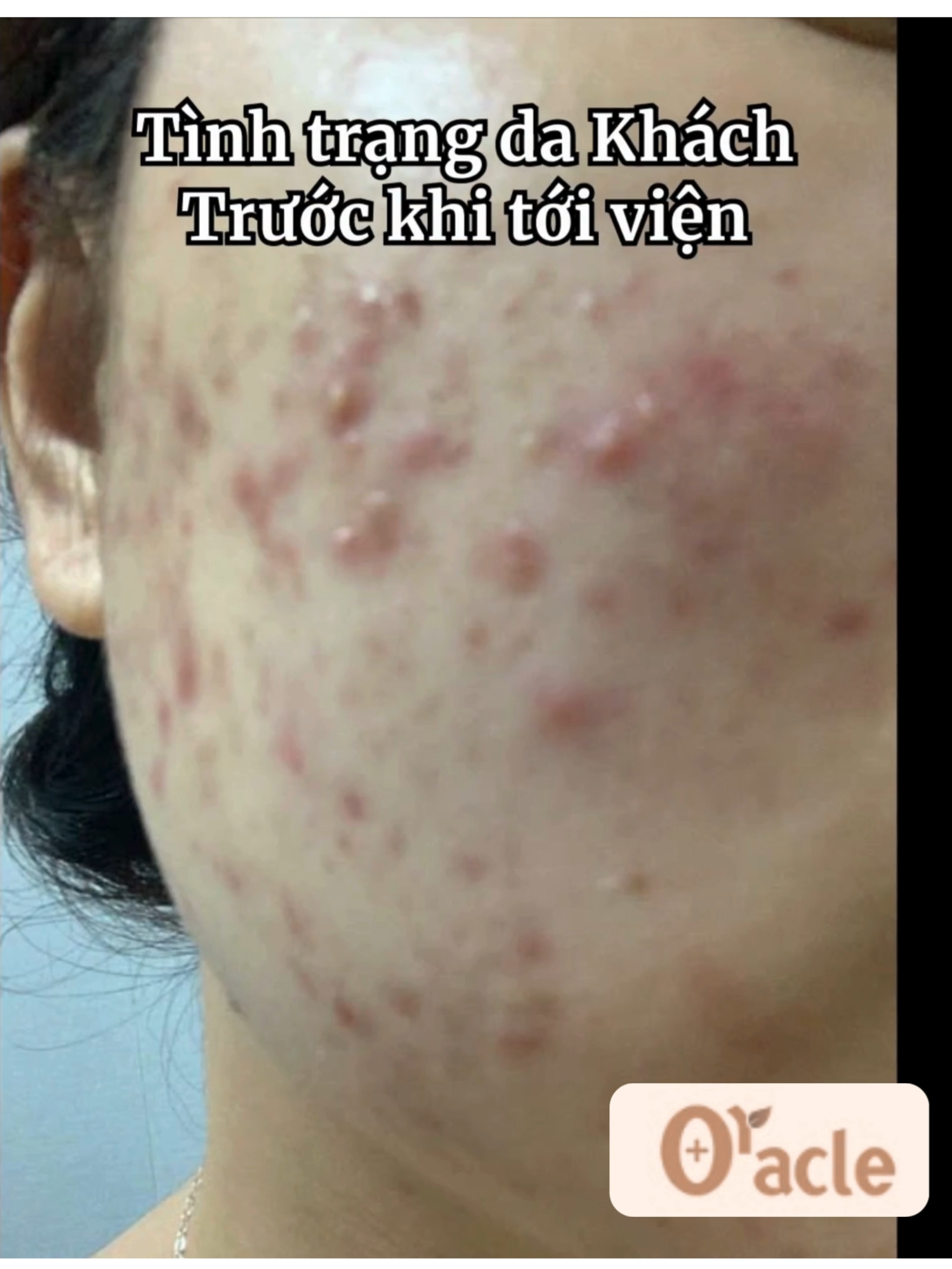 @Viện Da Liễu Oracle Cheongdam