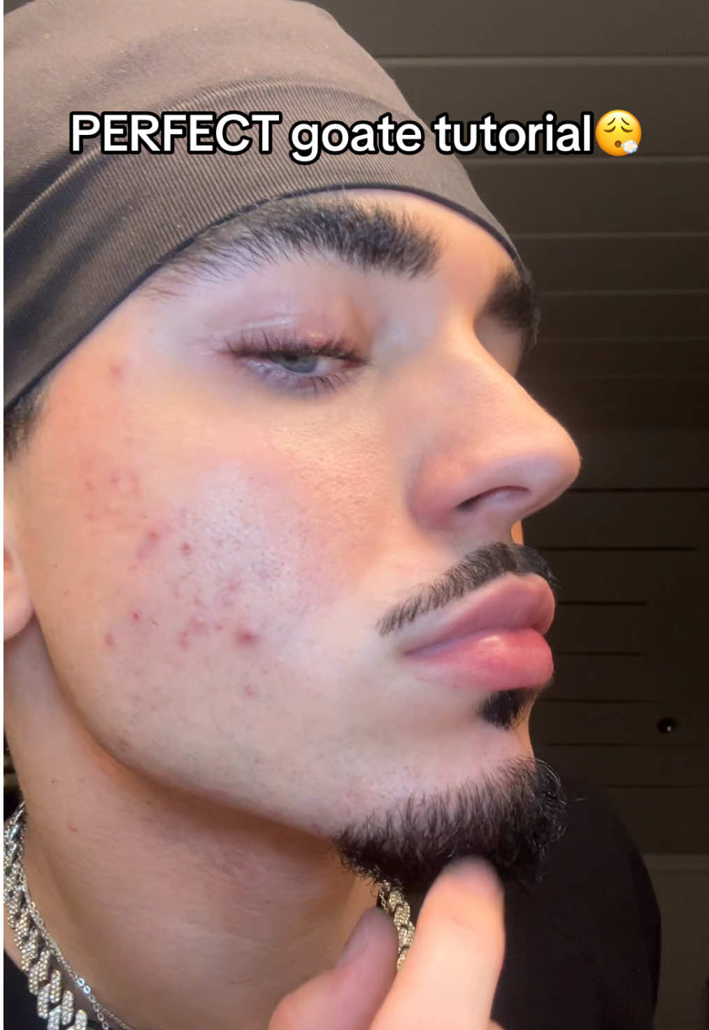 @Xeno