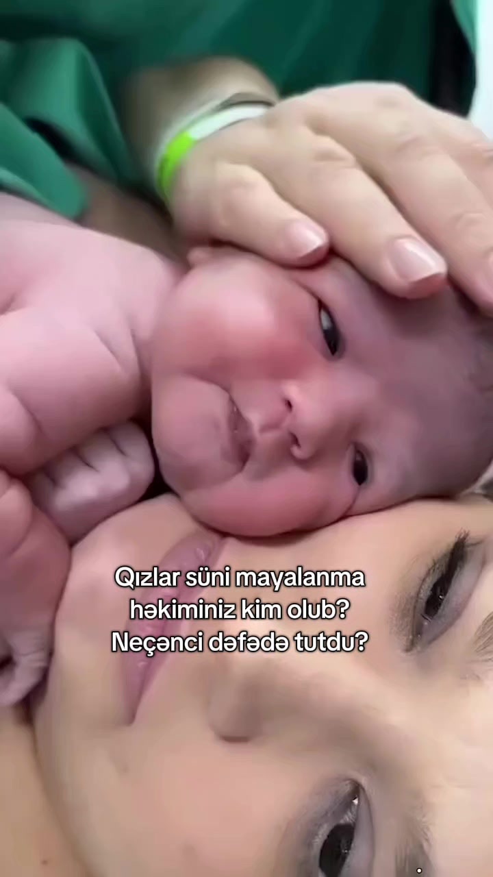 @K&ouml;rpə arzusu👶&Uuml;middən m&ouml;c&uuml;zəyə