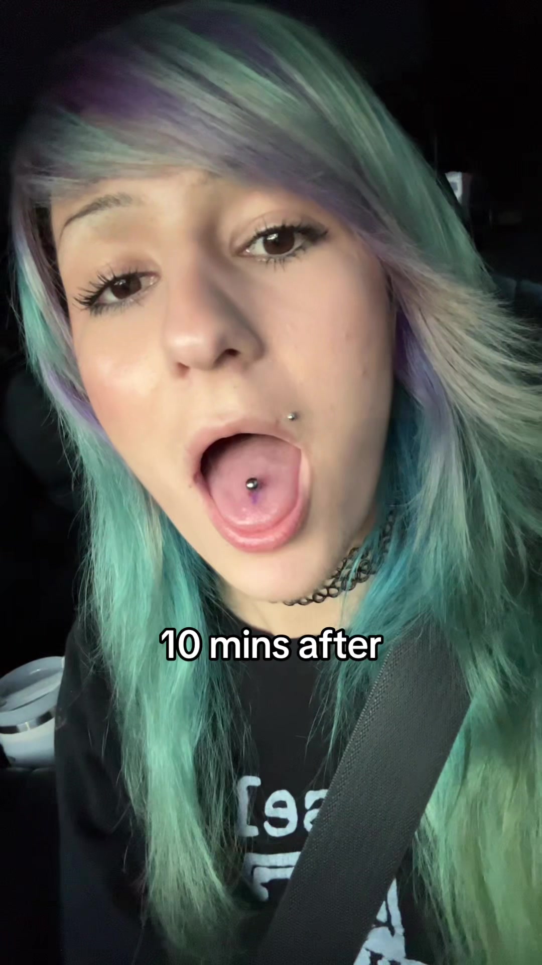@onnie