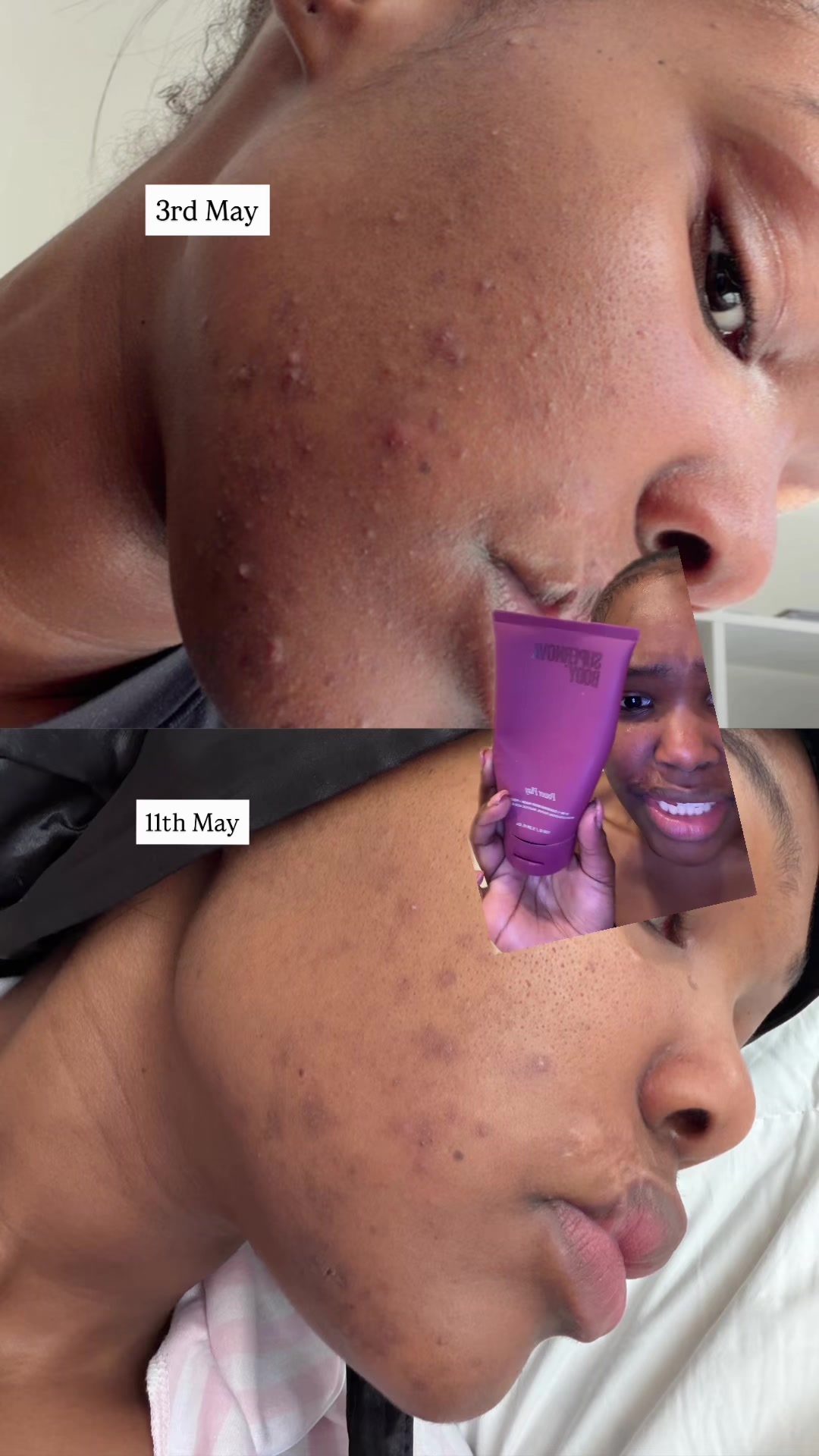 @Malaika