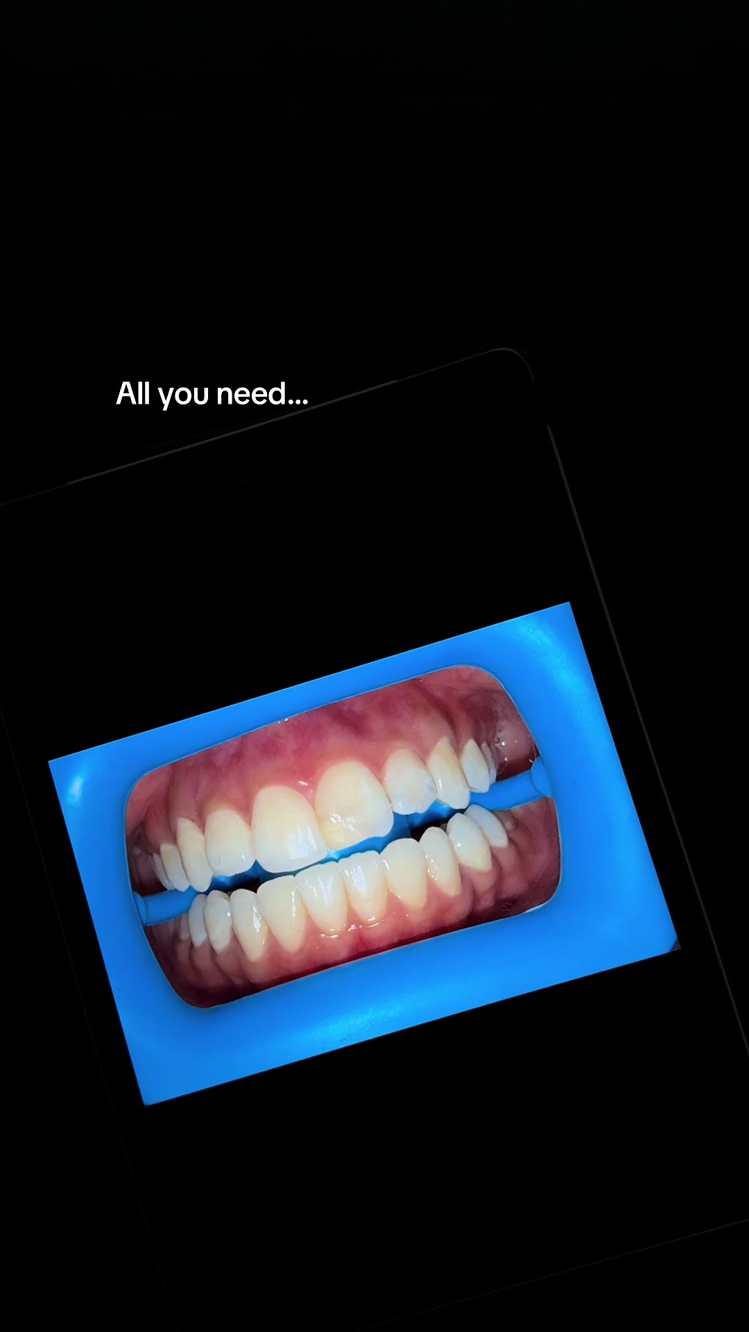 @Halal Teeth Whitening London