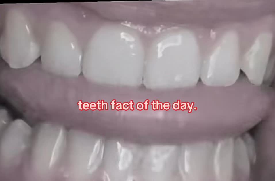 @I leik teeth moer thna mysefl.