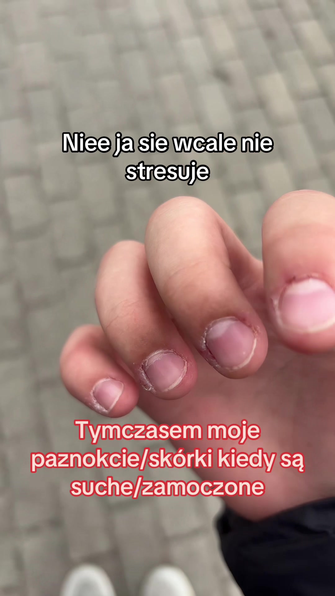 @🕊️🦓🪰