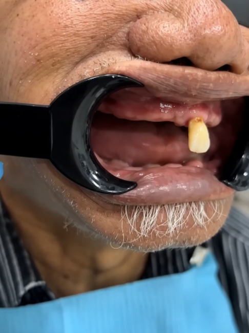 @DentalTreatment