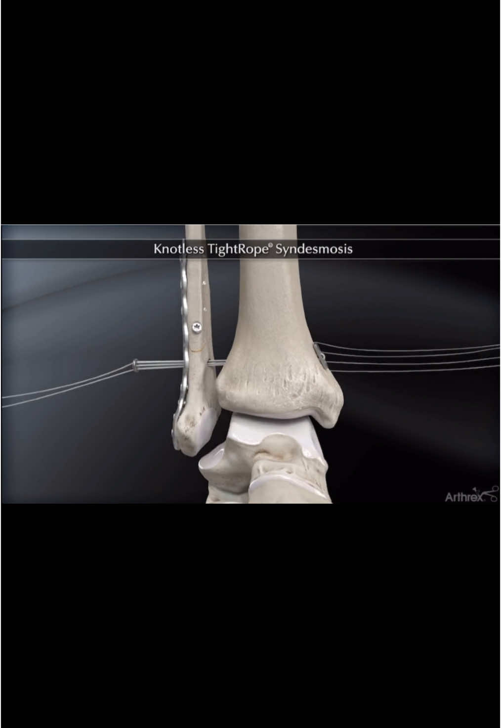 @Anatomias