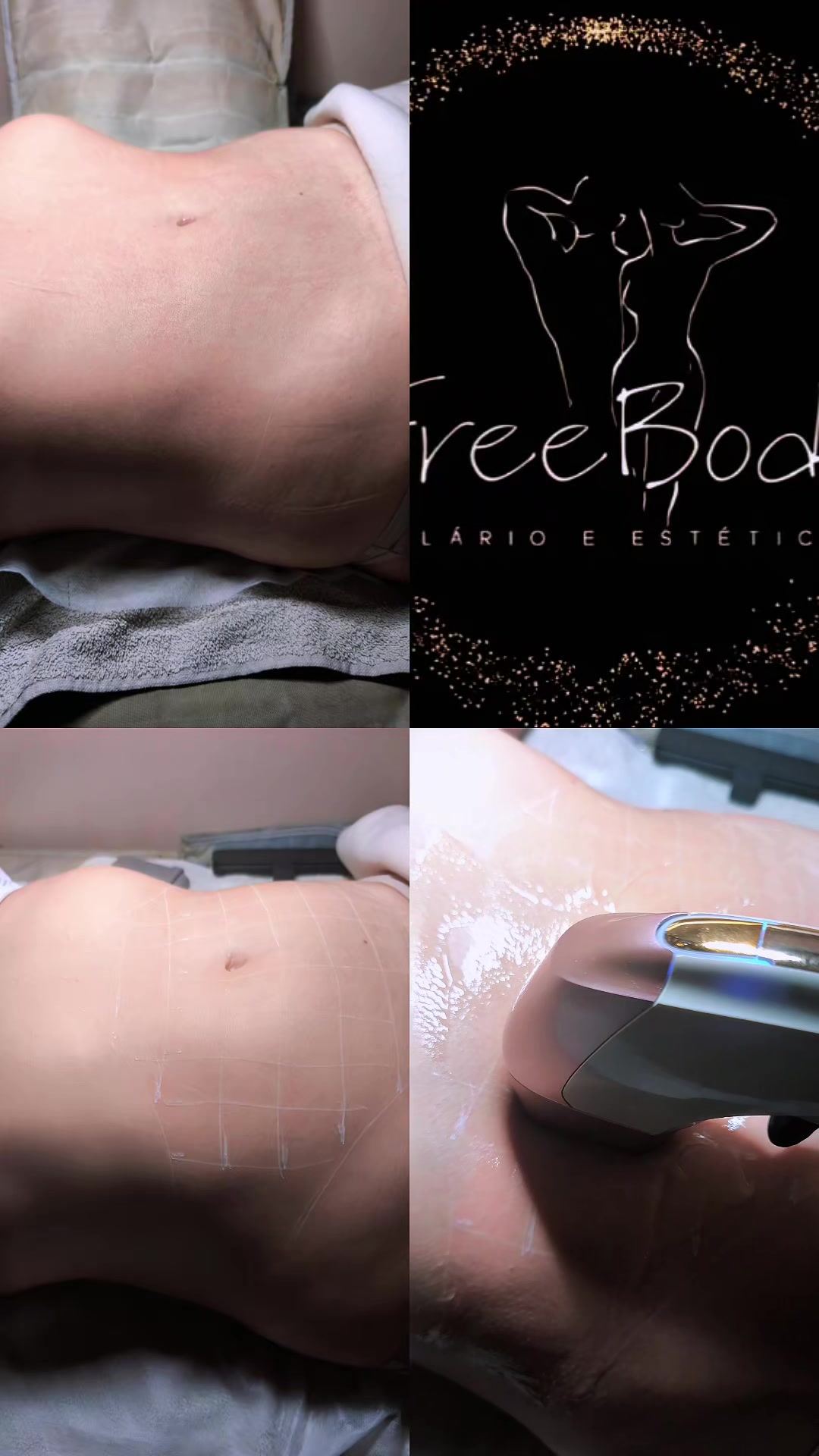 @FREEBODY SOLÁRIO E ESTÉTICA