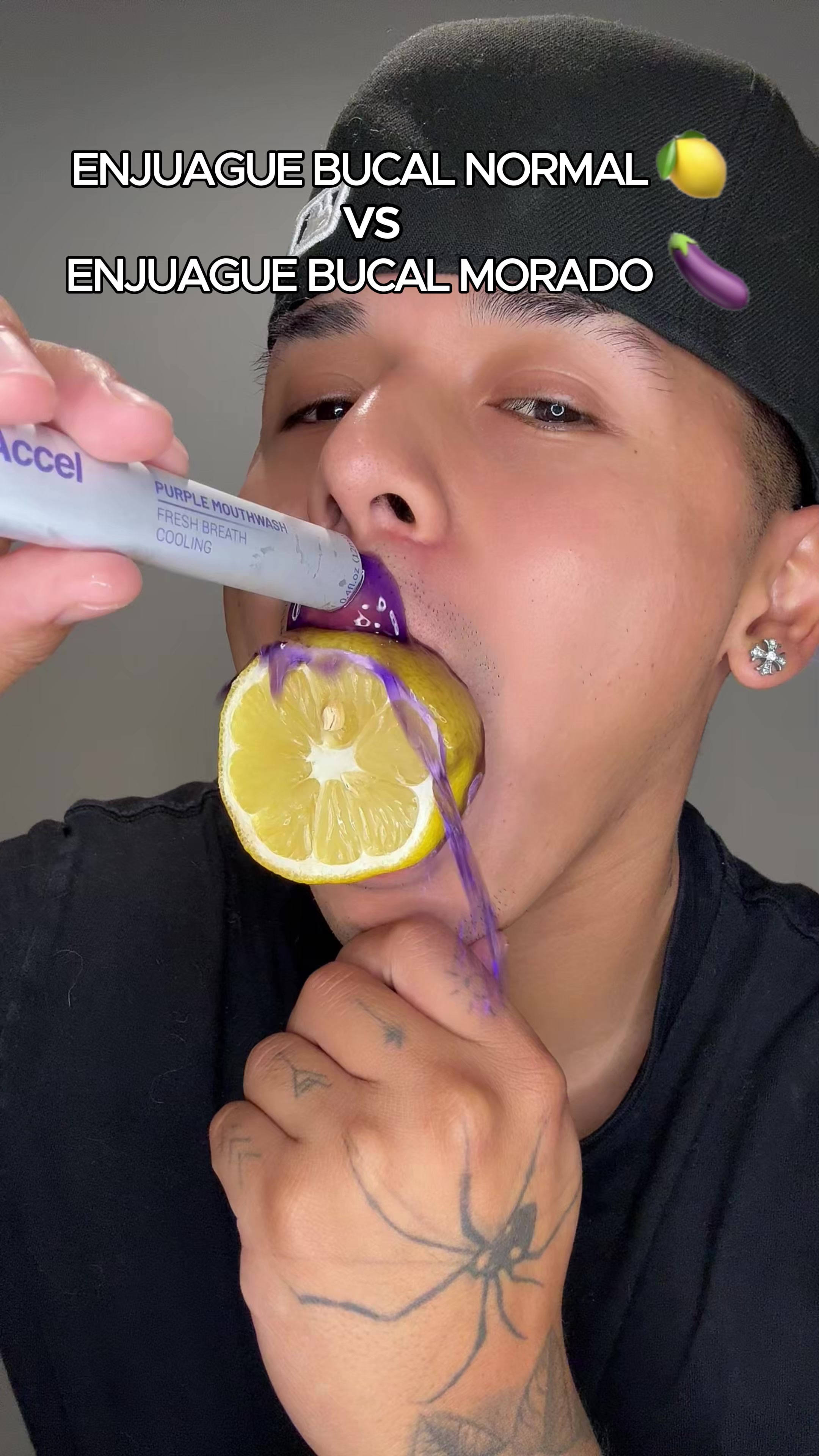 @Justin Carpio👑🕷️