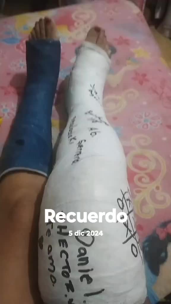 @Paty Patito Patita rota 🦴🦵🩼
