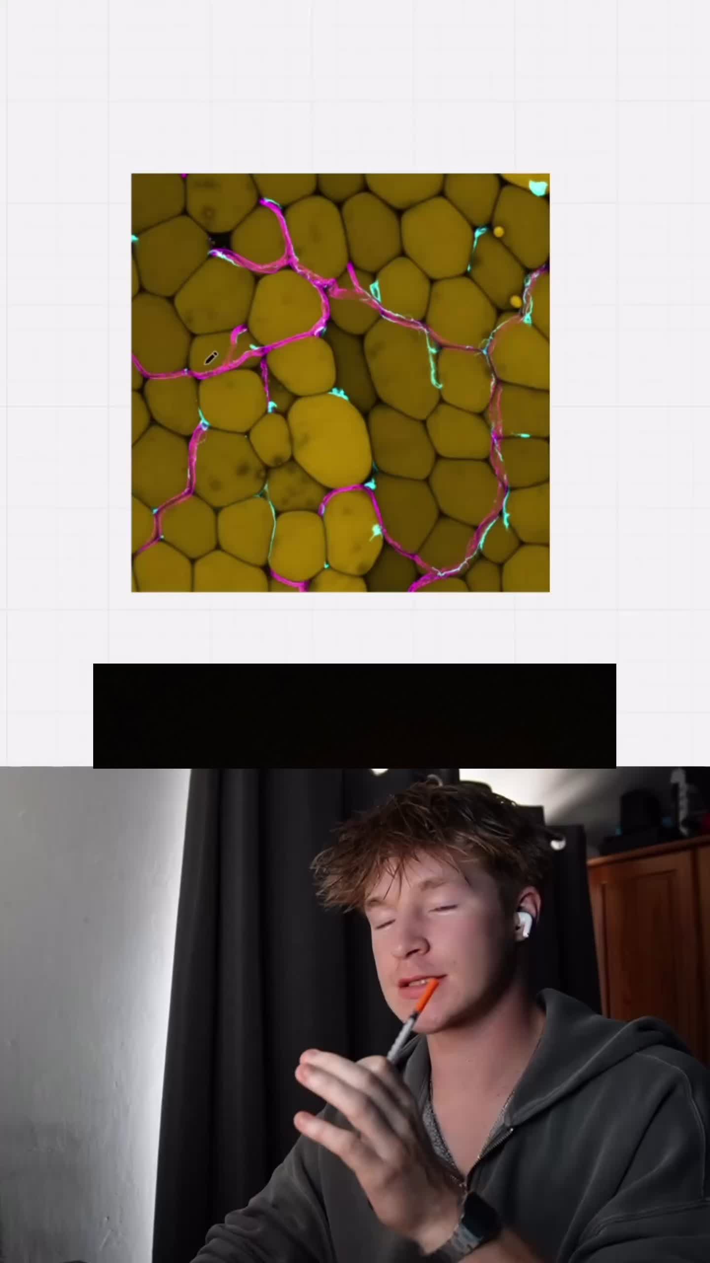 @Ben