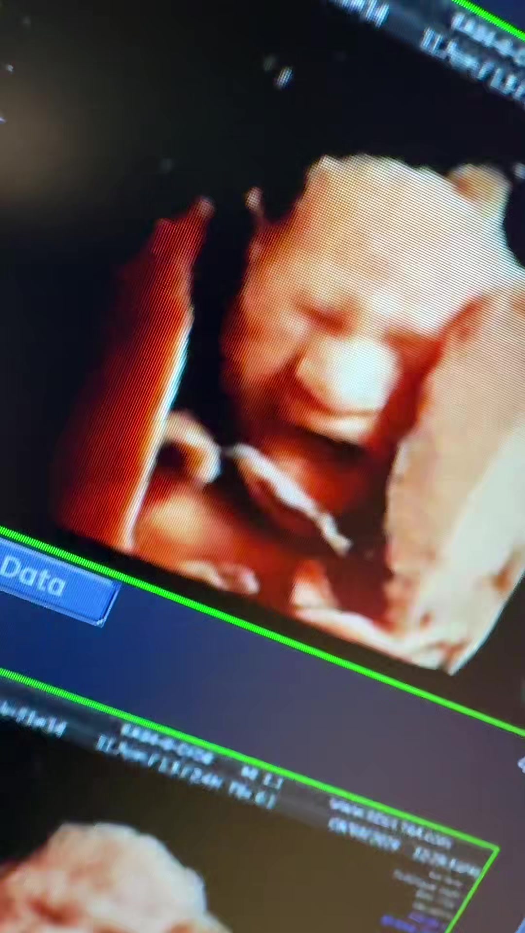 @PregnantSee Inc.