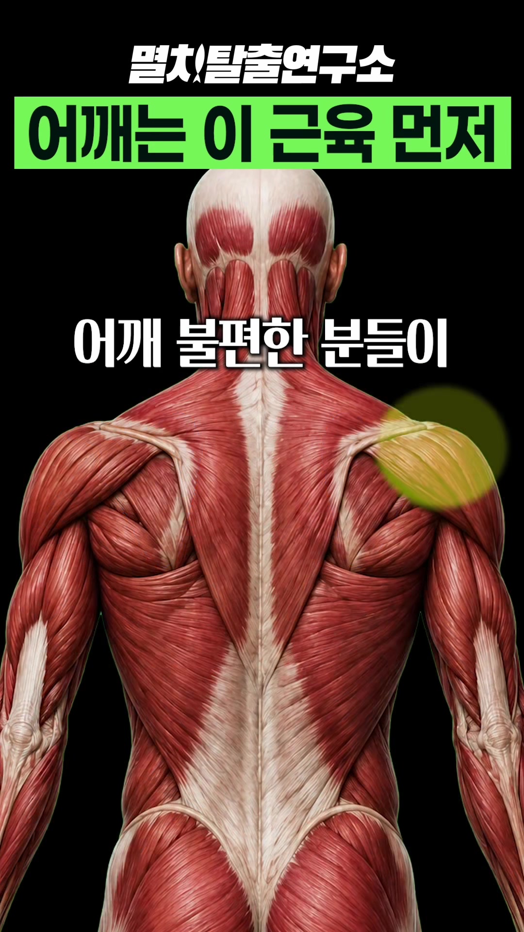 @멸치탈출연구소