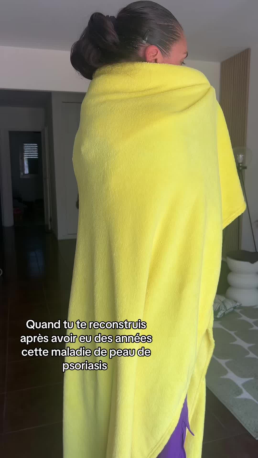 @lyla_psoriasistyle