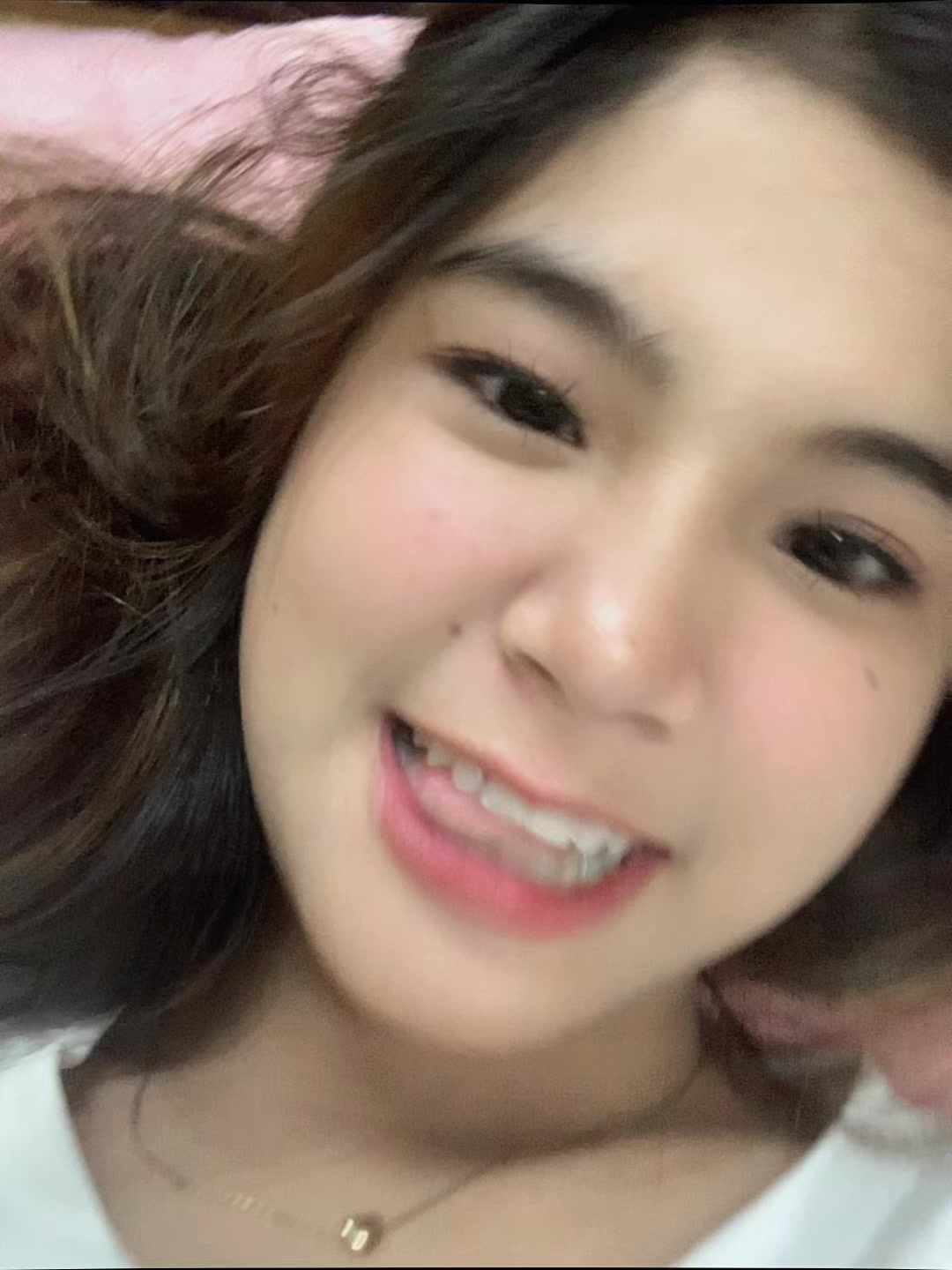 @Xay