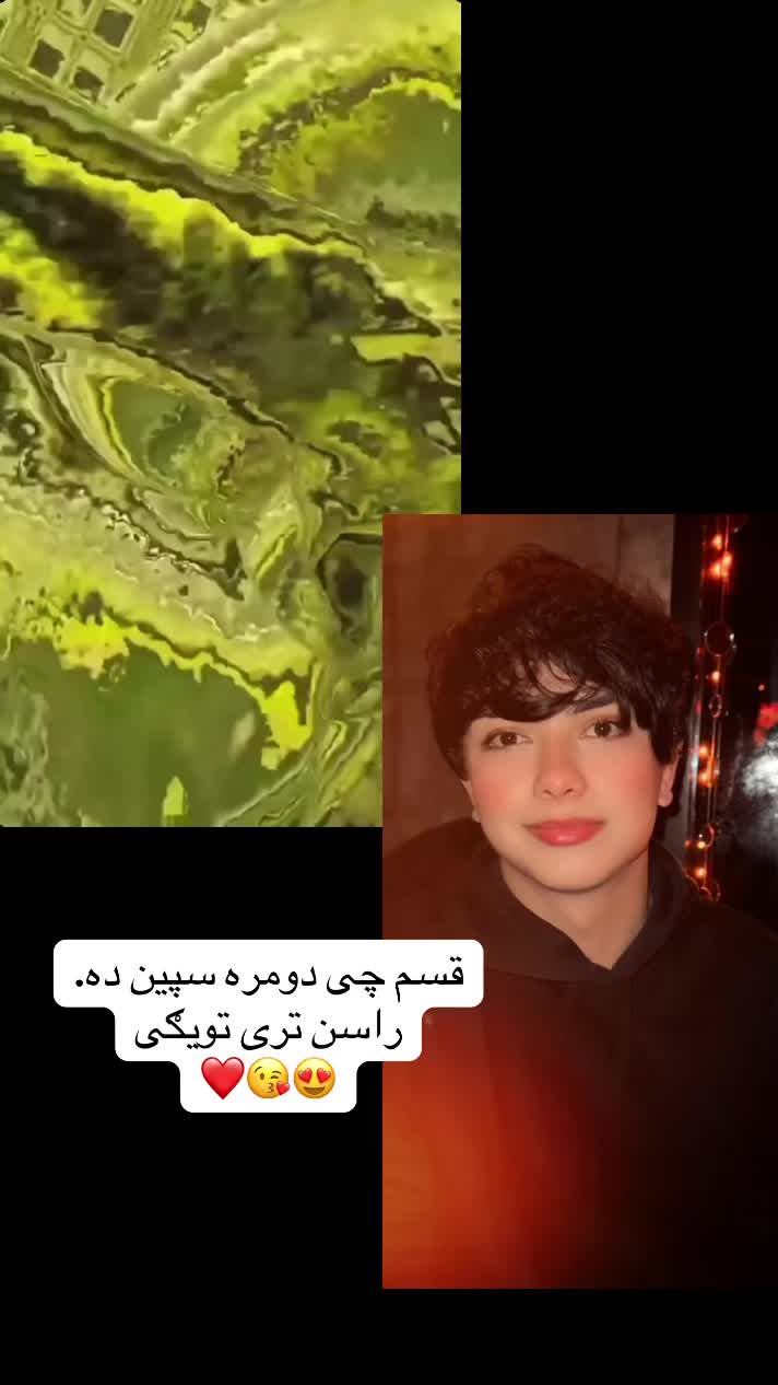 @🥺Ziba 🫠 Ahmadzai 💜💘
