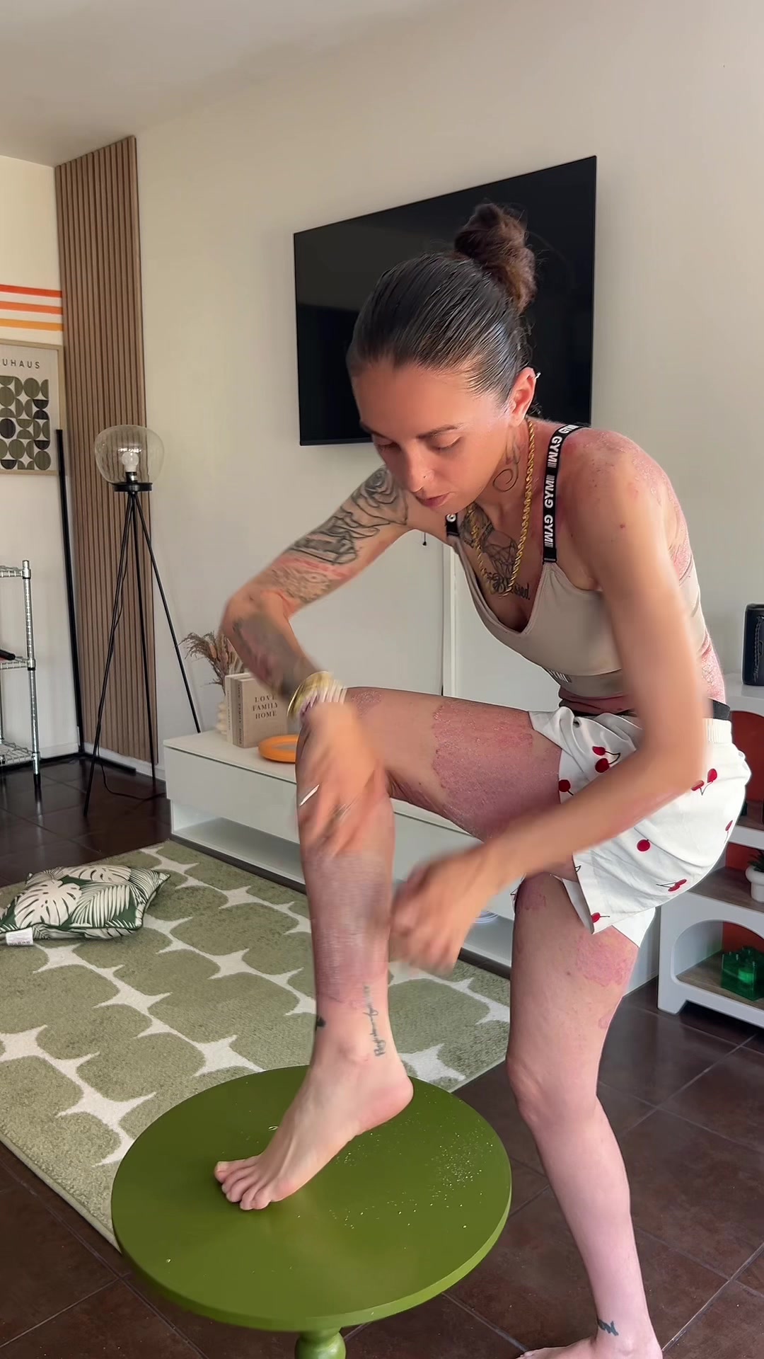 @lyla_psoriasistyle