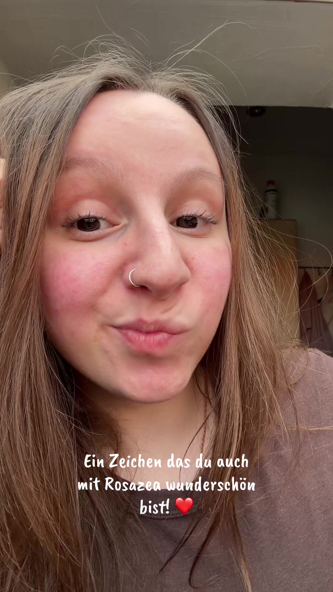 @Franzii🦋