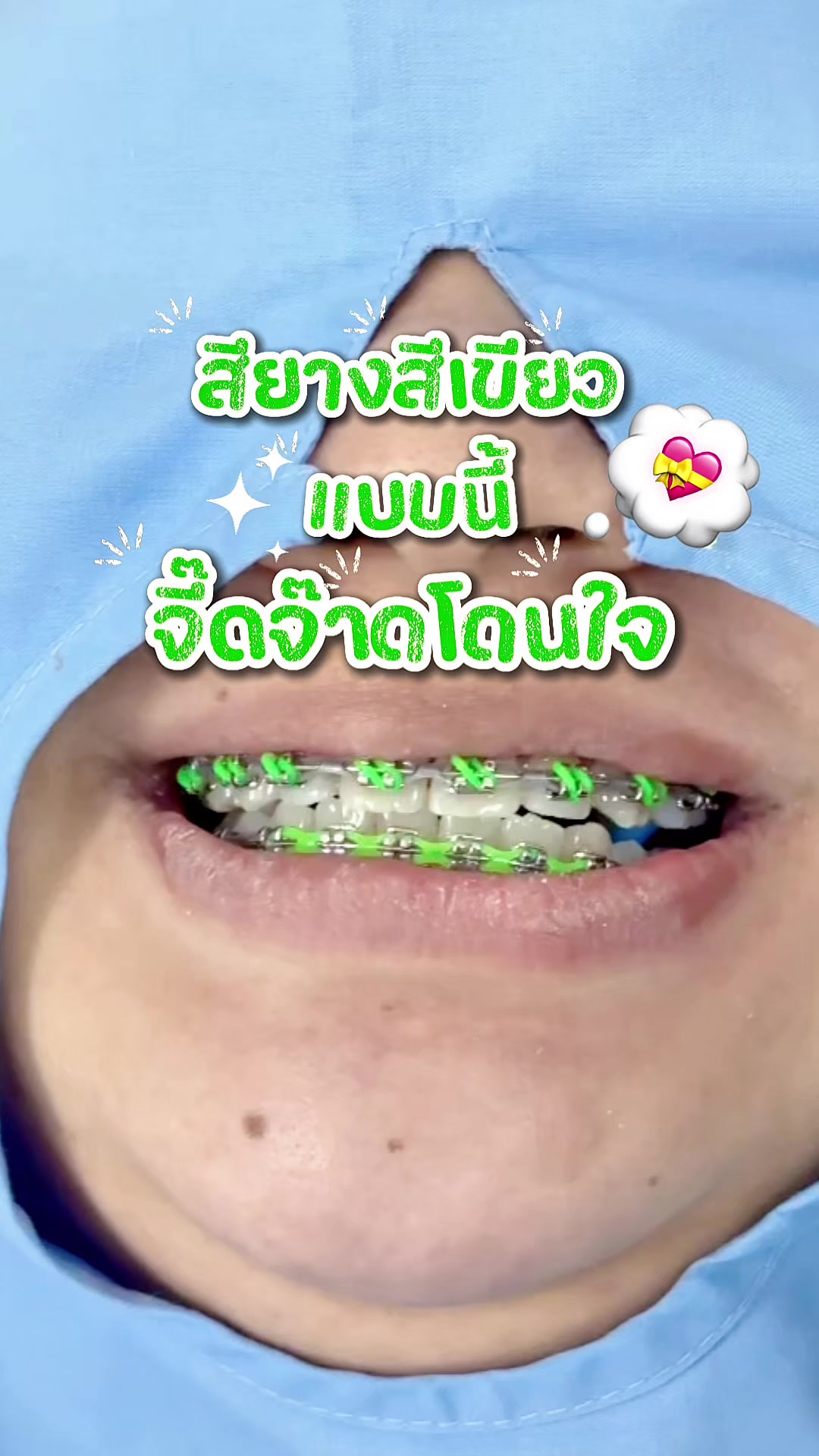 @ideasmilebu