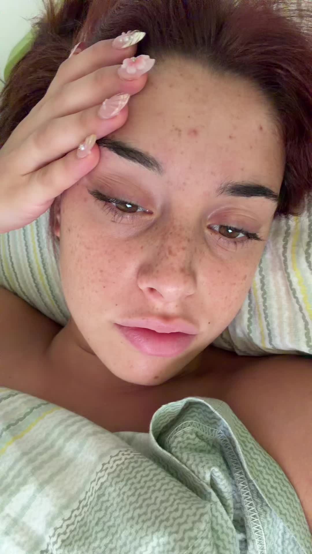 @Iris