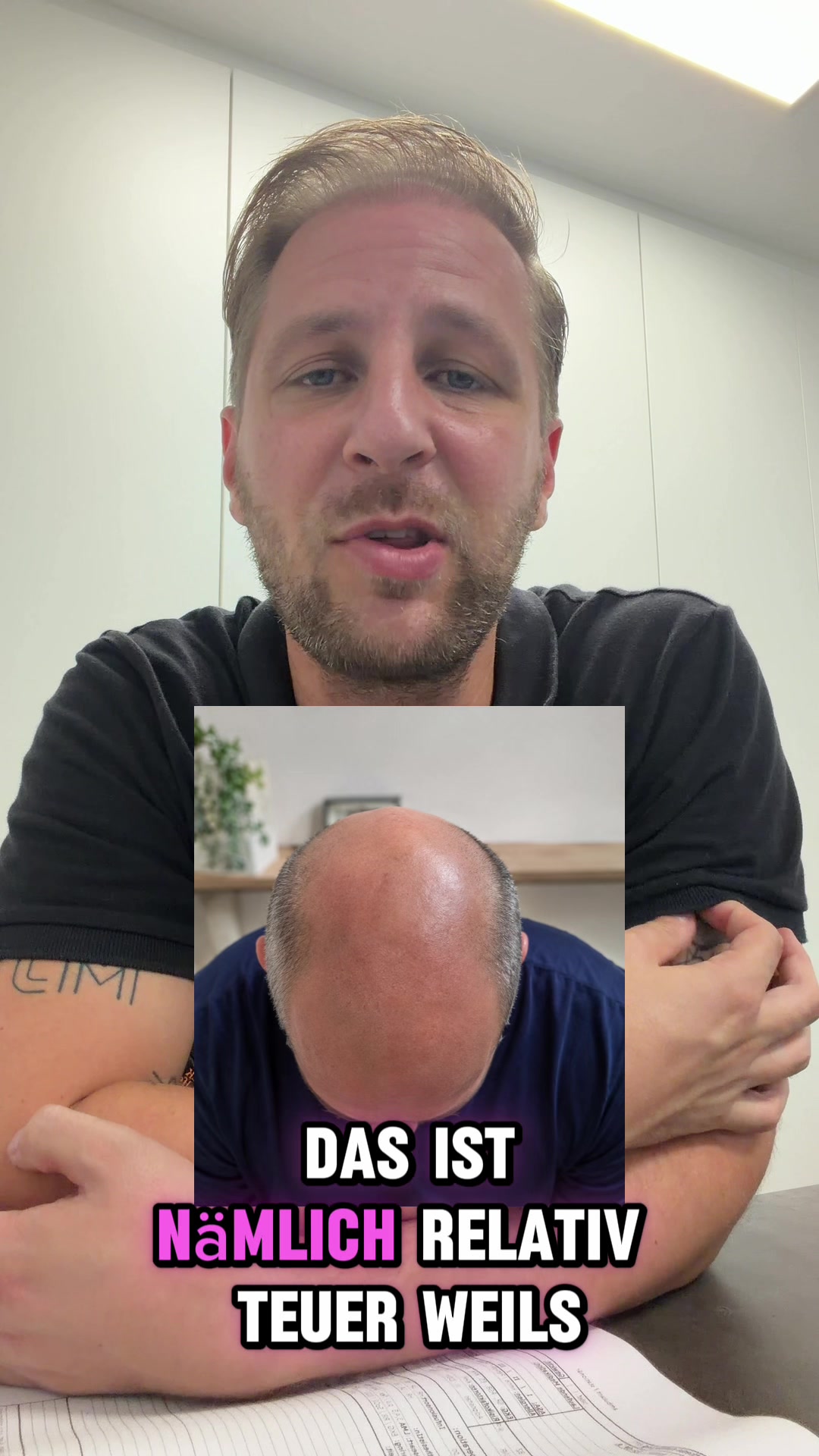 @Mr. Hairtransplant