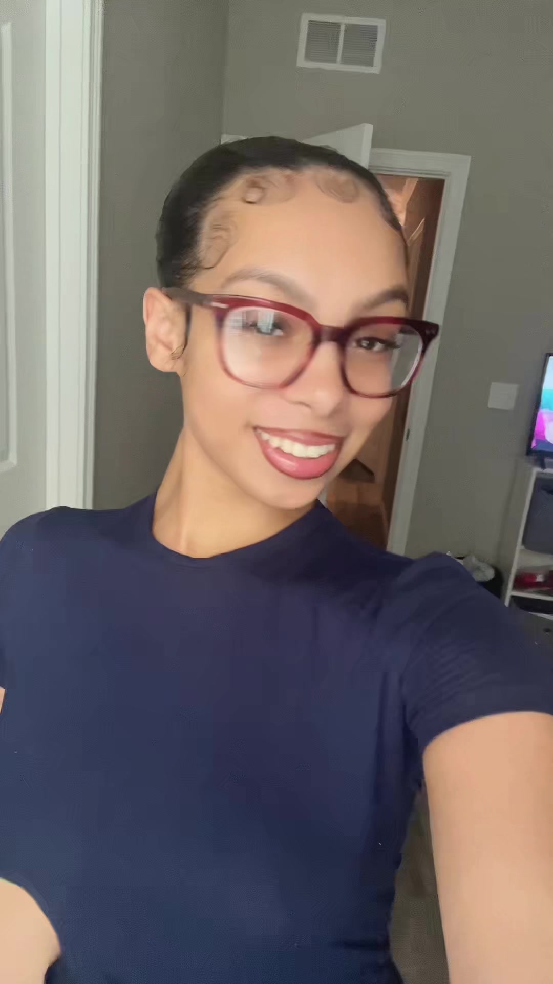 @endlessforehead005