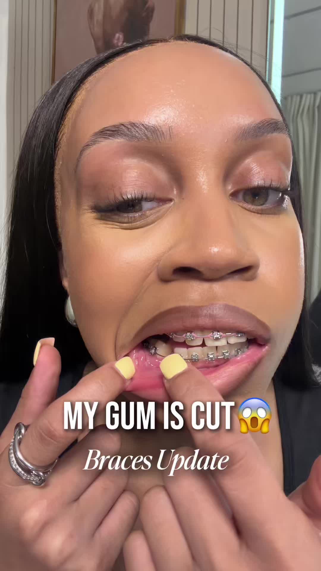 @Precious In Purpose