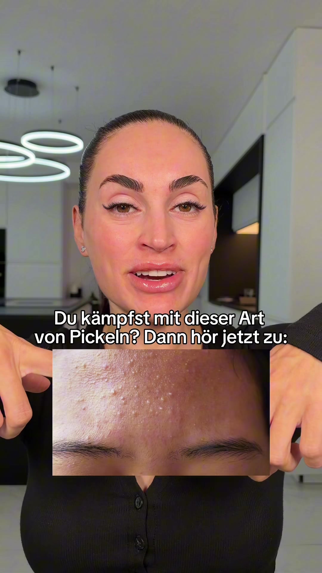 @Melissa | BEAUTYEXPERT