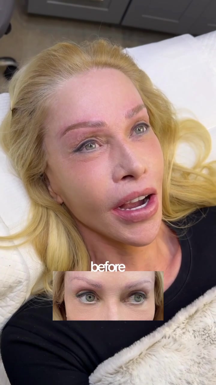 @MICROBLADING LA