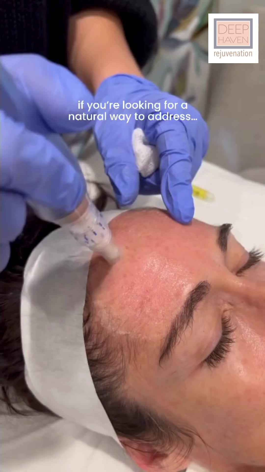 @DeepHaven Rejuvenation