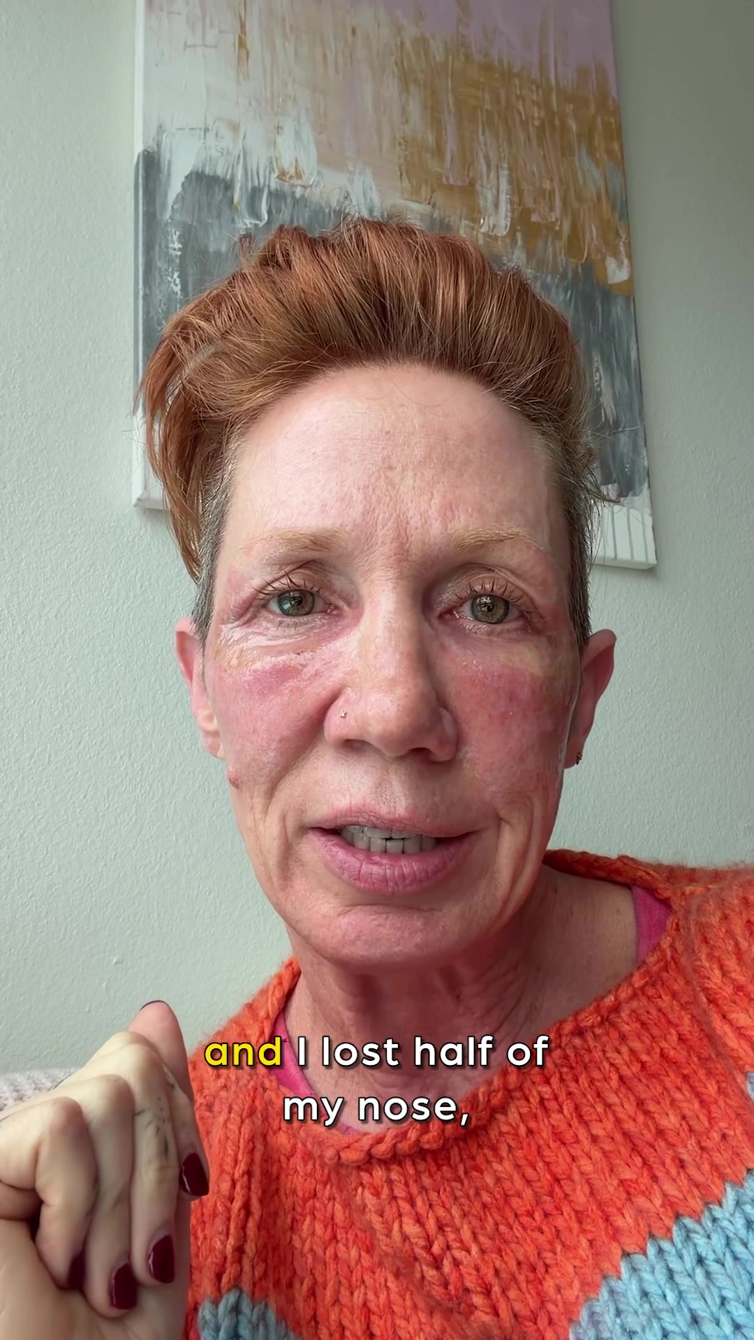 @Sabine Schoepke