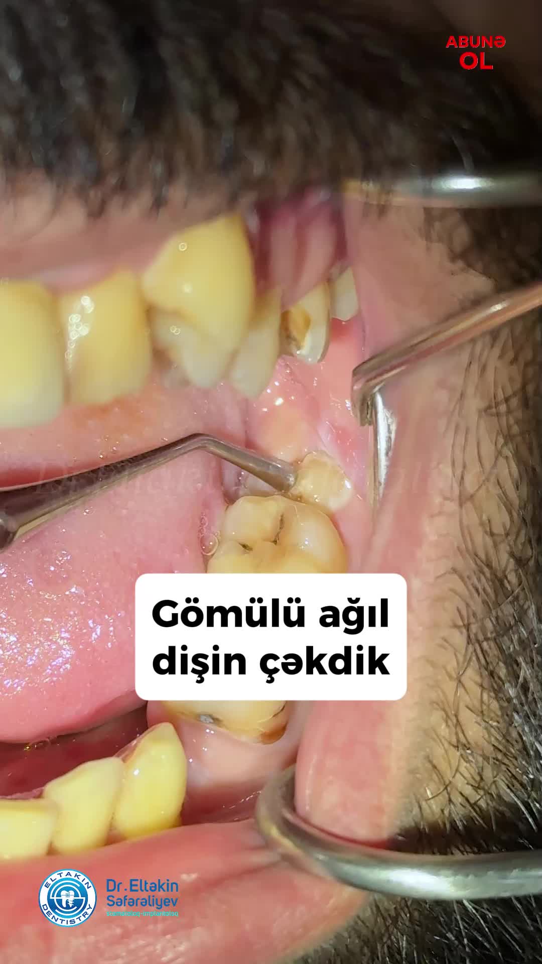 @eltakindentistry