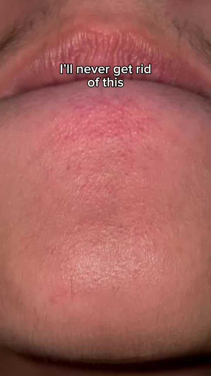 @Eyaannnn🕷️