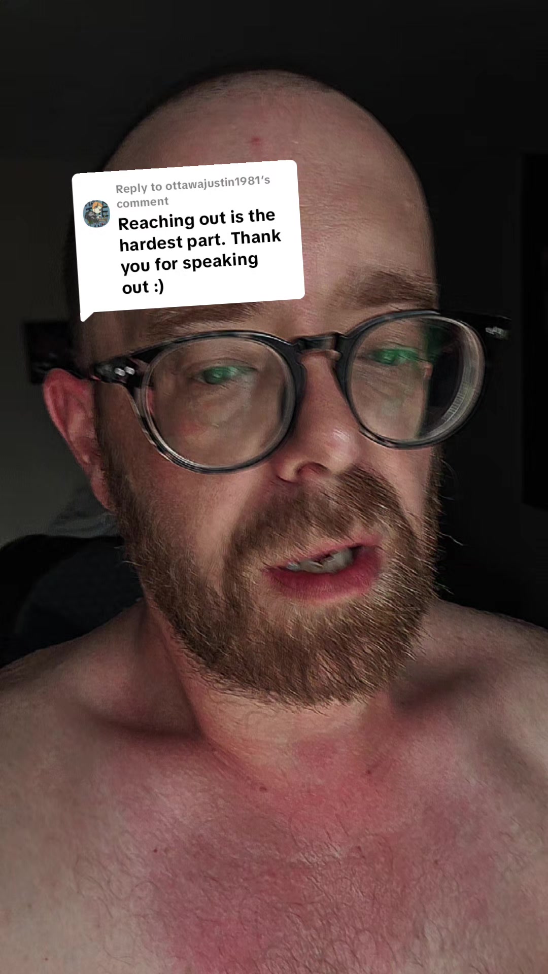 @Gonzo