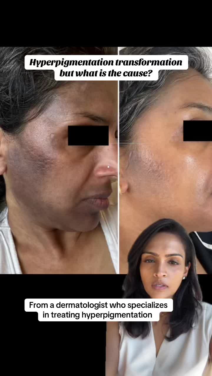 @Dr Paul, Dermatologist