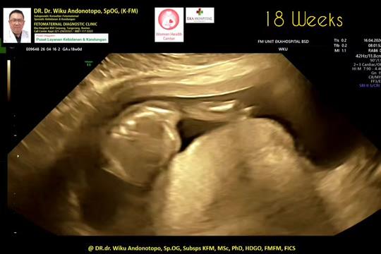 @DR.Dr.Wiku Andonotopo,SpOG KFM