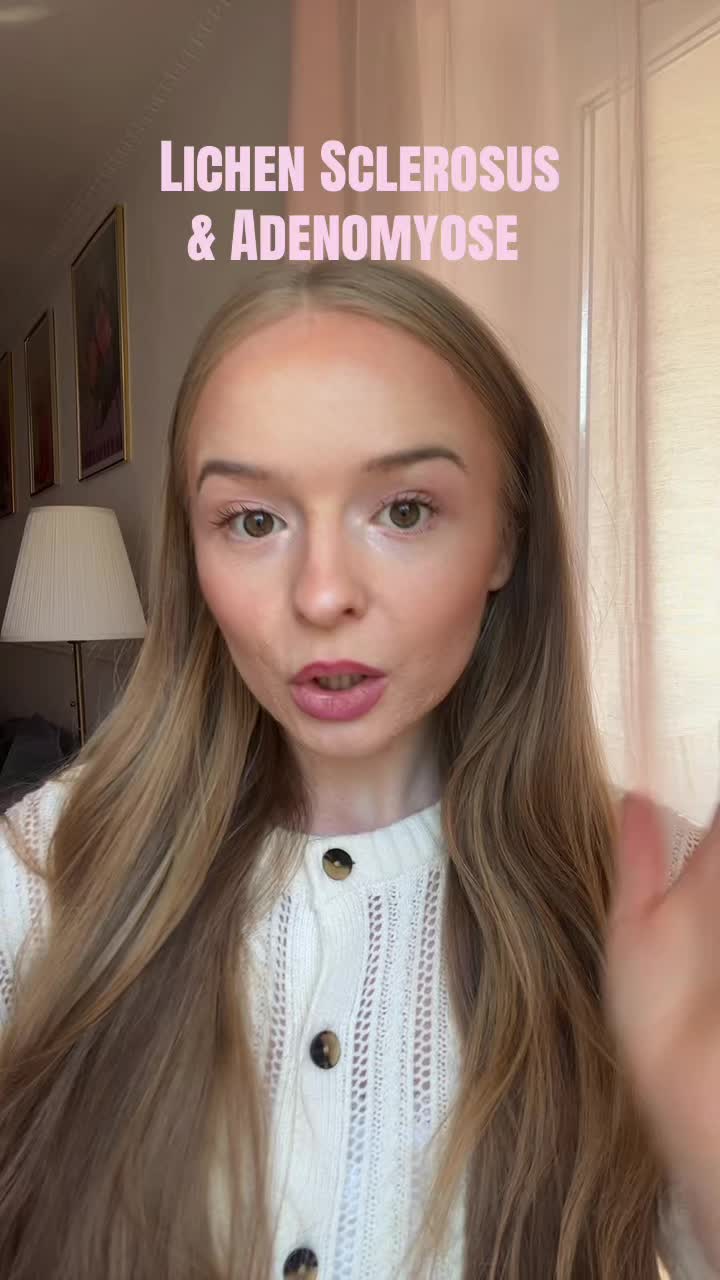 @rosaaa