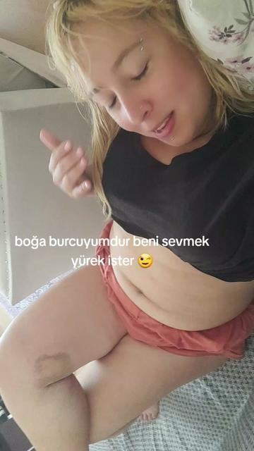 @HEPİNİZE DERT OLACAM BAK GÖR👀
