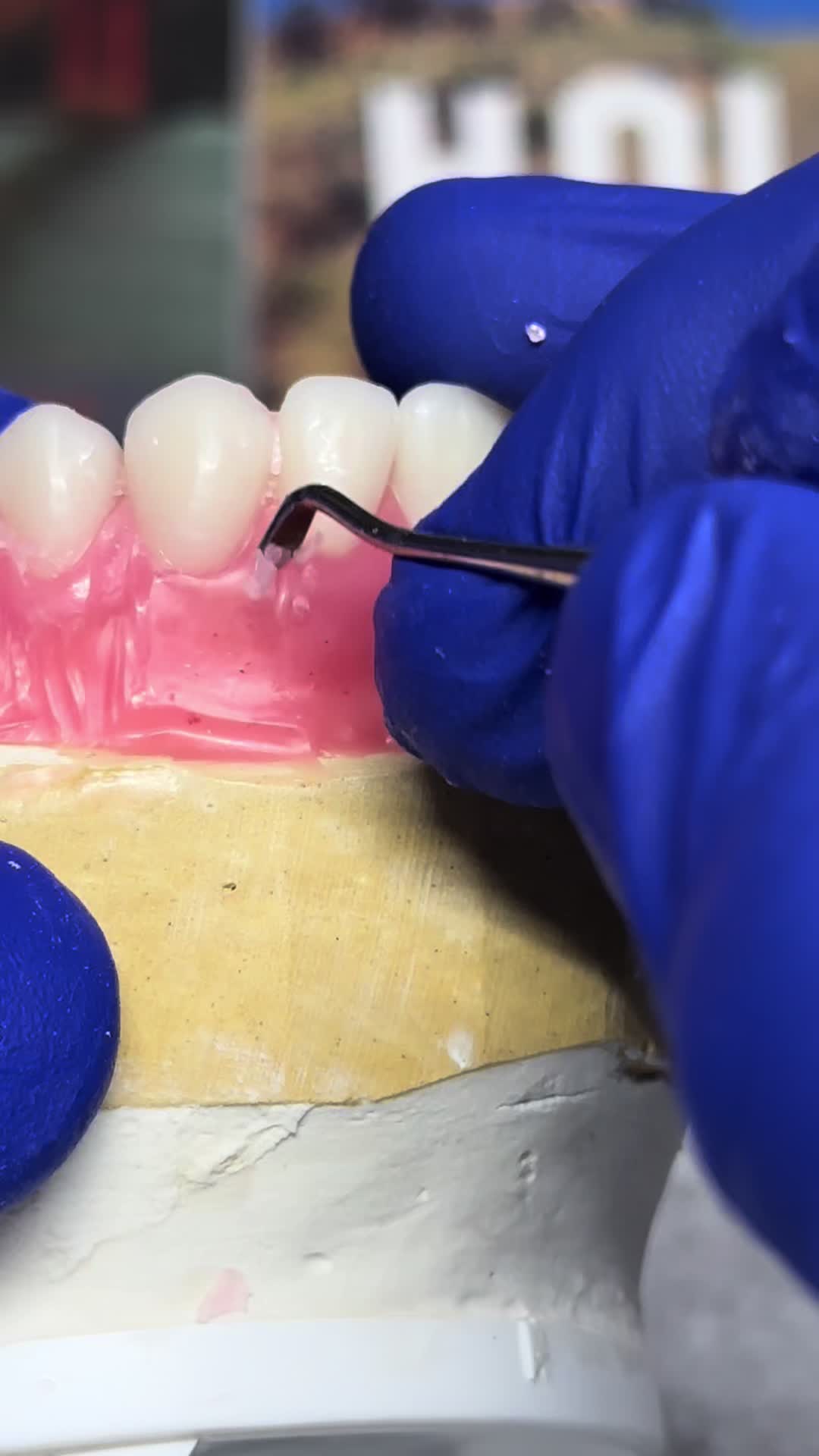 @Dental tech 🦷