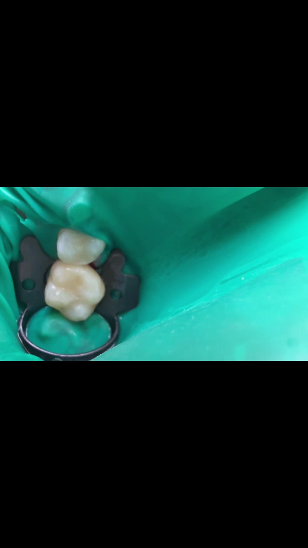 @Stomatolog Snejana Carabulea🦷