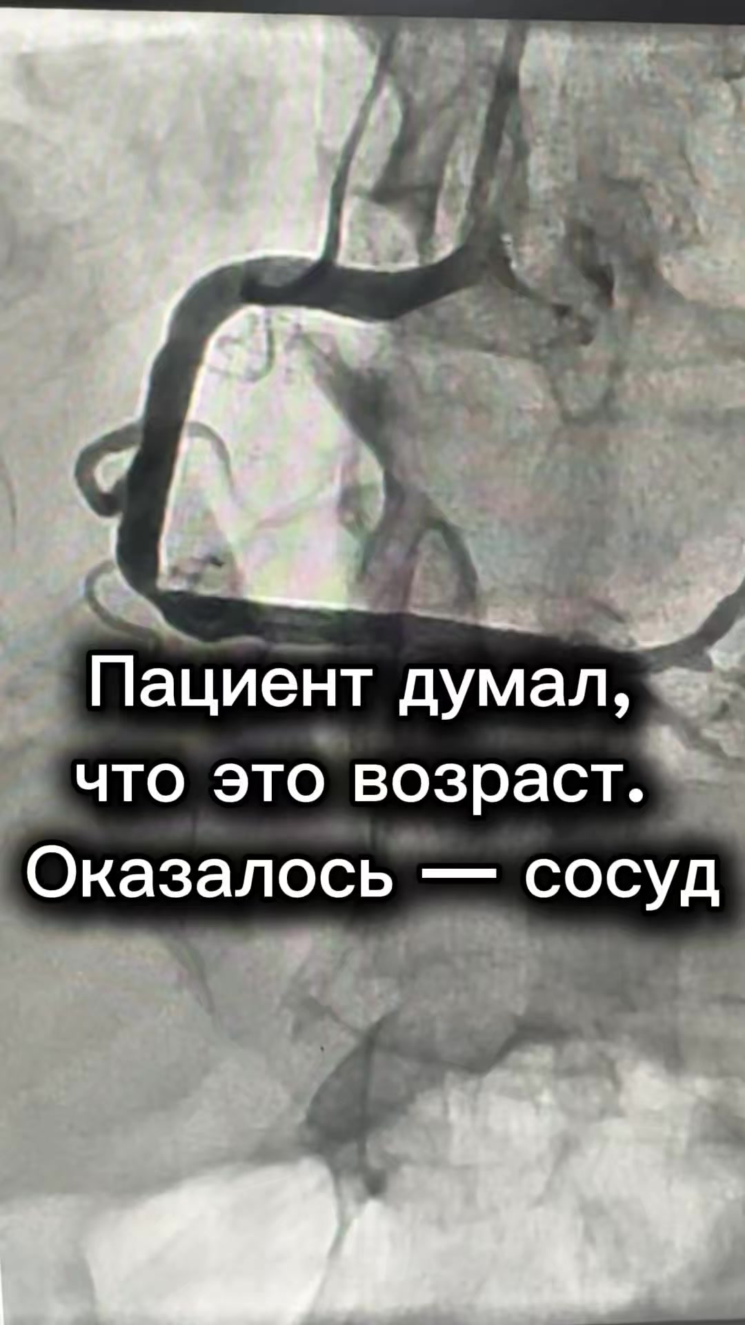 @Кардиолог / Аспет